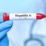 Hepatitis A