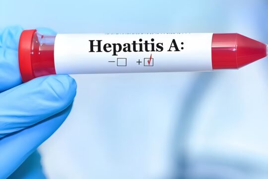 Hepatitis A
