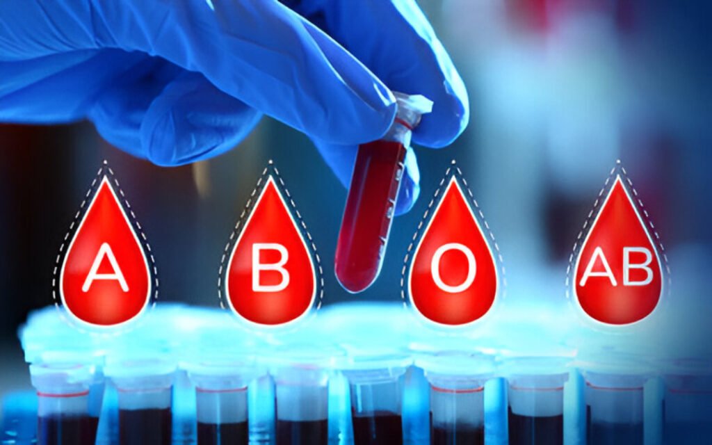 Is Your Blood Type Associated with Stroke Risk? New Research Clarifies