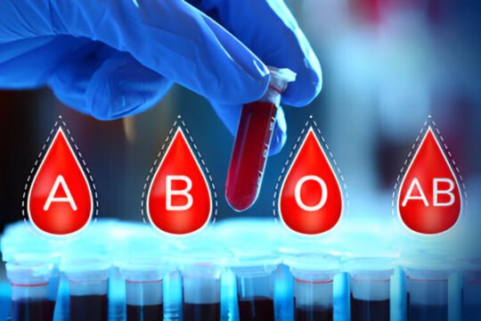 Is Your Blood Type Associated with Stroke Risk? New Research Clarifies